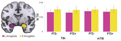 Associations of mTBI and post-traumatic stress to amygdala structure and functional connectivity in military Service Members